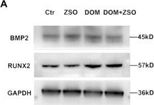 Fig.4.A showing Western Blotting in a Mus musculus (House mouse) sample from the publication: A new SO2 probe ZSO targeting VDBP inhibits high glucose induced endothelial cell senescence and calcification.