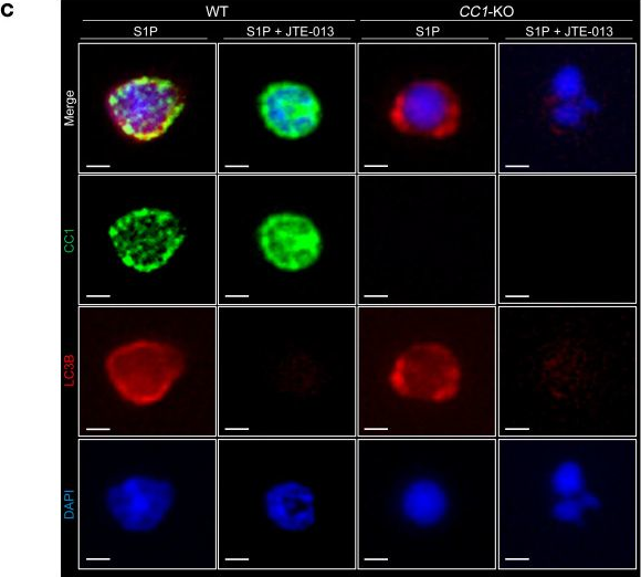 Fig.6.C showing Immunocytochemistry-immunofluorescence from the publication: Neutrophil CEACAM1 determines susceptibility to NETosis by regulating the S1PR2/S1PR3 axis in liver transplantation.