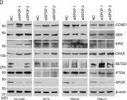 Fig.6.D showing Western Blotting in a Homo sapiens (Human) sample from the publication: SPOP suppresses prostate cancer through regulation of CYCLIN E1 stability.