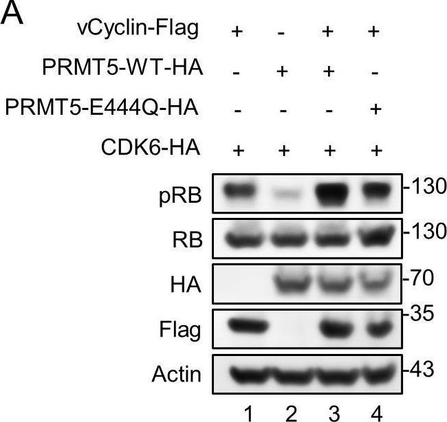 Fig.7.A showing Western Blotting in a Homo sapiens (Human) sample from the publication: Methylation of KSHV vCyclin by PRMT5 contributes to cell cycle progression and cell proliferation.