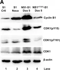 Fig.3.A showing Western Blotting in a Homo sapiens (Human) sample from the publication: Parvovirus B19 NS1 protein induces cell cycle arrest at G2-phase by activating the ATR-CDC25C-CDK1 pathway.