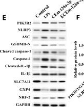 Fig.7.E showing Western Blotting from the publication: Double-Responsive Macrophage-Derived Exosomes Alleviate Acute Lung Injury.