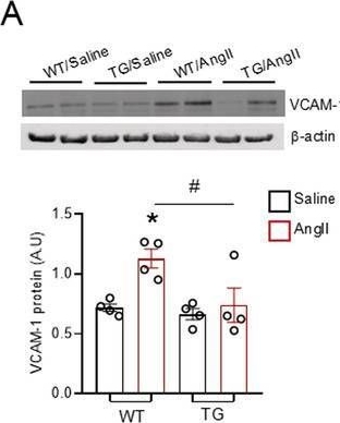 Fig.5.A showing Western Blotting from the publication: Endothelial NADPH oxidase 4 protects against angiotensin II-induced cardiac fibrosis and inflammation.