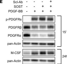 Fig.5.E showing Western Blotting in a Mus musculus (House mouse) sample from the publication: Sclerostin blockade inhibits bone resorption through PDGF receptor signaling in osteoblast lineage cells.