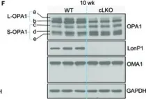 Fig.2.F showing Western Blotting from the publication: LonP1 Links Mitochondria-ER Interaction to Regulate Heart Function.