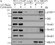 Fig.9.A showing Western Blotting in a Homo sapiens (Human) sample from the publication: The dynein adaptor Hook2 plays essential roles in mitotic progression and cytokinesis.
