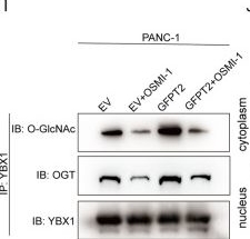 Fig.6.I showing Western Blotting in a Homo sapiens (Human) sample from the publication: The GFPT2-O-GlcNAcylation-YBX1 axis promotes IL-18 secretion to regulate the tumor immune microenvironment in pancreatic cancer.
