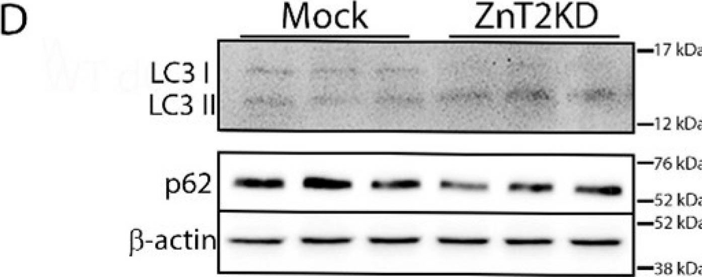 Fig.6.D showing Western Blotting from the publication: ZnT2 Is Critical for TLR4-Mediated Cytokine Expression in Colonocytes and Modulates Mucosal Inflammation in Mice.