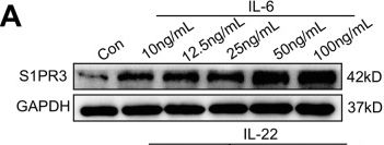 Fig.6.A showing Western Blotting from the publication: S1PR3-driven positive feedback loop sustains STAT3 activation and keratinocyte hyperproliferation in psoriasis.
