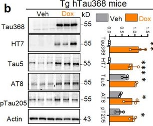 Fig.1.B showing Western Blotting from the publication: Calbindin-D28k deficiency mediates tau-driven hippocampal hyperexcitement and cognitive impairment.