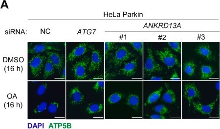 Fig.2.A showing Immunocytochemistry-immunofluorescence in a Homo sapiens (Human) sample from the publication: The ubiquitin-binding protein ANKRD13A mediates VCP-dependent mitochondrial outer membrane rupture during PINK1/Parkin-mediated mitophagy.