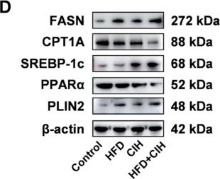 Fig.6.D showing Western Blotting from the publication: Chronic Intermittent Hypoxia Exacerbates High-Fat Diet-Induced MASLD Through Lipid Metabolic Reprogramming, Impaired Antioxidant Defense, and NF-κB/NLRP3 Activation.