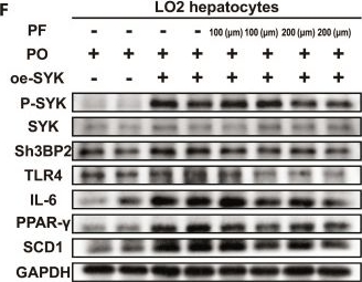 Fig.8.F showing Western Blotting from the publication: Paeoniflorin Ameliorates Metabolic Dysfunction-Associated Steatotic Liver Disease by SYK/SH3BP2 Signaling Pathway.