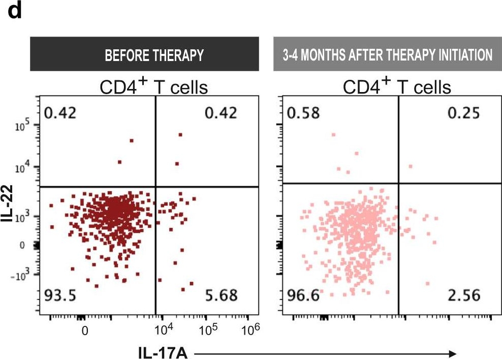 Fig.4.D showing Flow cytometry/Cell sorting in a Homo sapiens (Human) sample from the publication: Th17-associated cytokines IL-17 and IL-23 in inflamed skin of Darier disease patients as potential therapeutic targets.