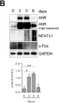 Fig.1.B showing Western Blotting from the publication: Inhibition of Human Osteoclast Differentiation by Kynurenine through the Aryl-Hydrocarbon Receptor Pathway.