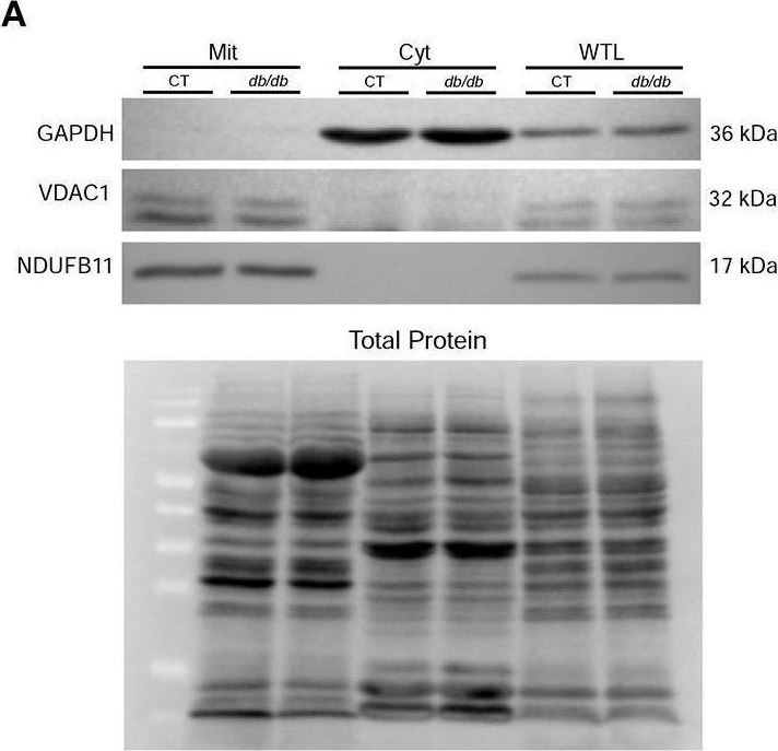 Fig.7.A showing Western Blotting in a Mus musculus (House mouse) sample from the publication: Proteomic Analysis Suggests Altered Mitochondrial Metabolic Profile Associated With Diabetic Cardiomyopathy.