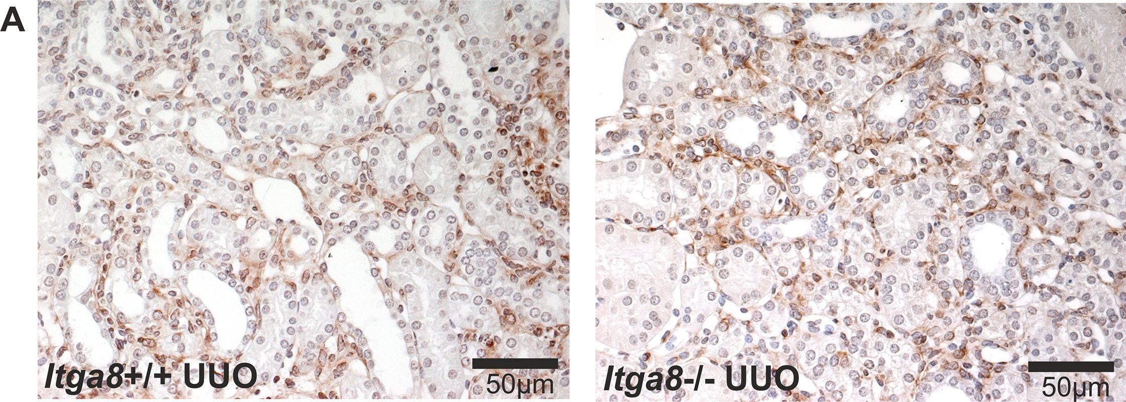 Alpha8 Integrin (Itga8) Signalling Attenuates Chronic Renal Interstitial Fibrosis by Reducing Fibroblast Activation, Not by Interfering with Regulation of Cell Turnover.