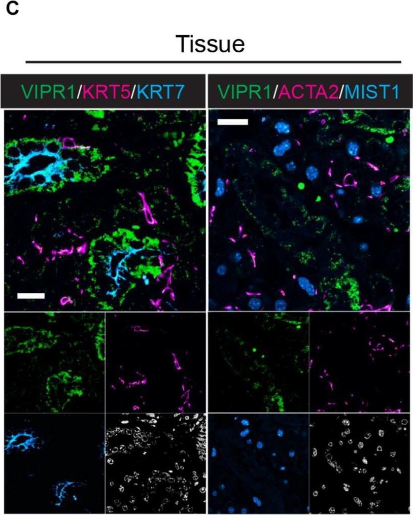 Fig.3.C showing Immunohistochemistry-immunofluorescence in a Mus musculus (House mouse) sample from the publication: 3D Organoid Culture From Adult Salivary Gland Tissues as an ex vivo Modeling of Salivary Gland Morphogenesis.