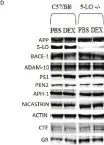 Fig.5.D showing Western Blotting from the publication: Involvement of 5-lipoxygenase in the corticosteroid-dependent amyloid beta formation: in vitro and in vivo evidence.