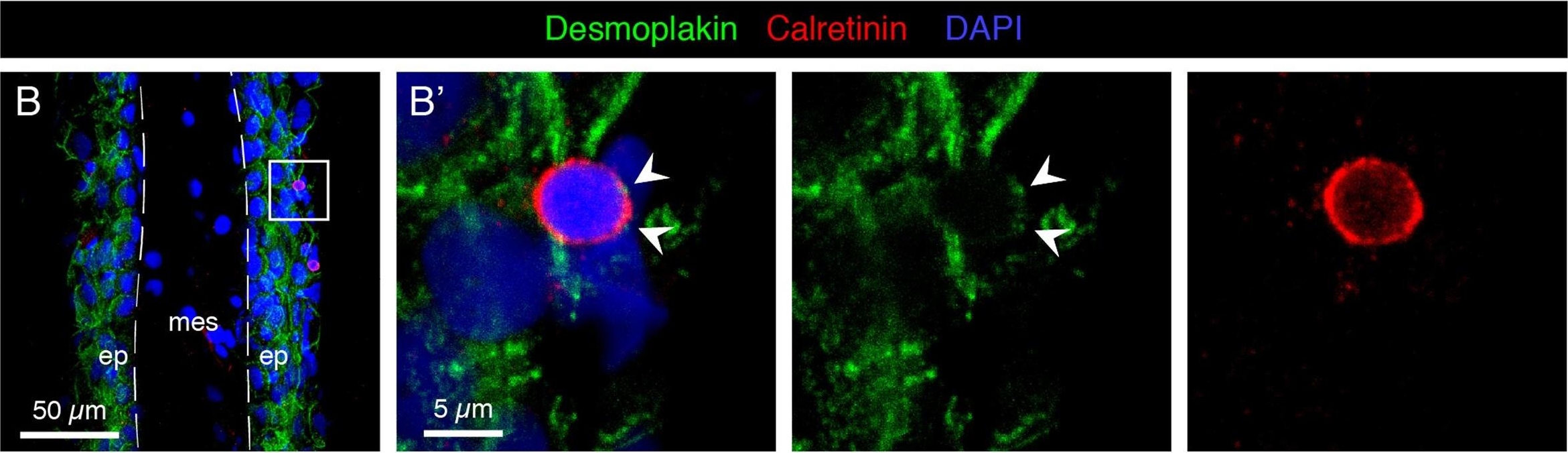 Distribution and Restoration of Serotonin-Immunoreactive Paraneuronal Cells During Caudal Fin Regeneration in Zebrafish.