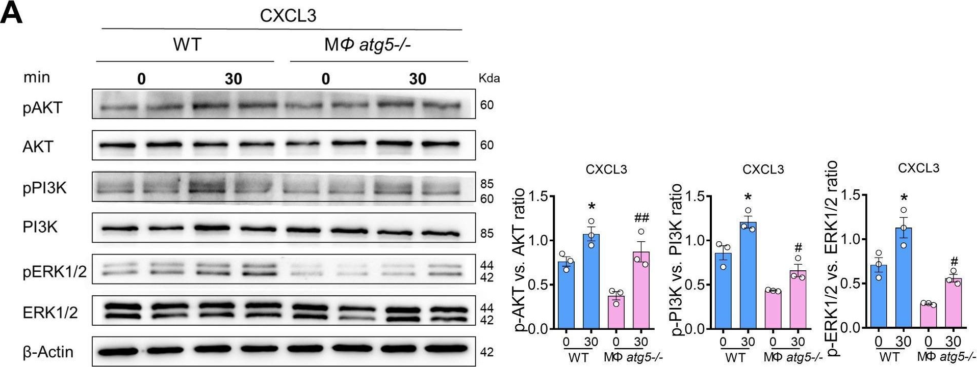 Fig.8.A showing Western Blotting from the publication: Atg5 deficiency in macrophages protects against kidney fibrosis via the CCR6-CCL20 axis.