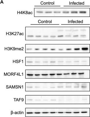 Fig.3.A showing Western Blotting from the publication: Multilevel Proteomics Reveals Epigenetic Signatures in BCG-Mediated Macrophage Activation.