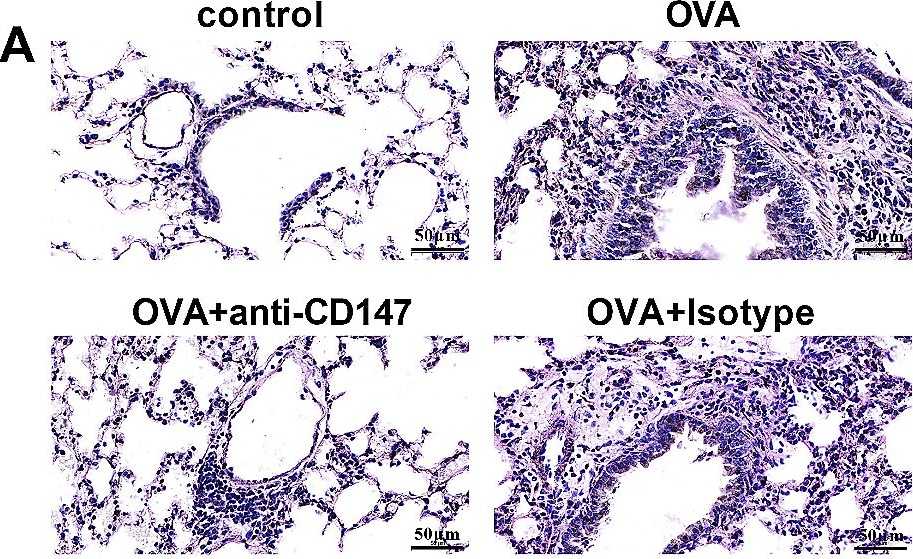 Fig.2.A showing Immunohistochemistry from the publication: CD147 induces asthmatic airway remodeling and activation of circulating fibrocytes in a mouse model of asthma.