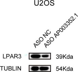 Fig.6.A showing Western Blotting in a Homo sapiens (Human) sample from the publication: AP003352.1/miR-141-3p axis enhances the proliferation of osteosarcoma by LPAR3.