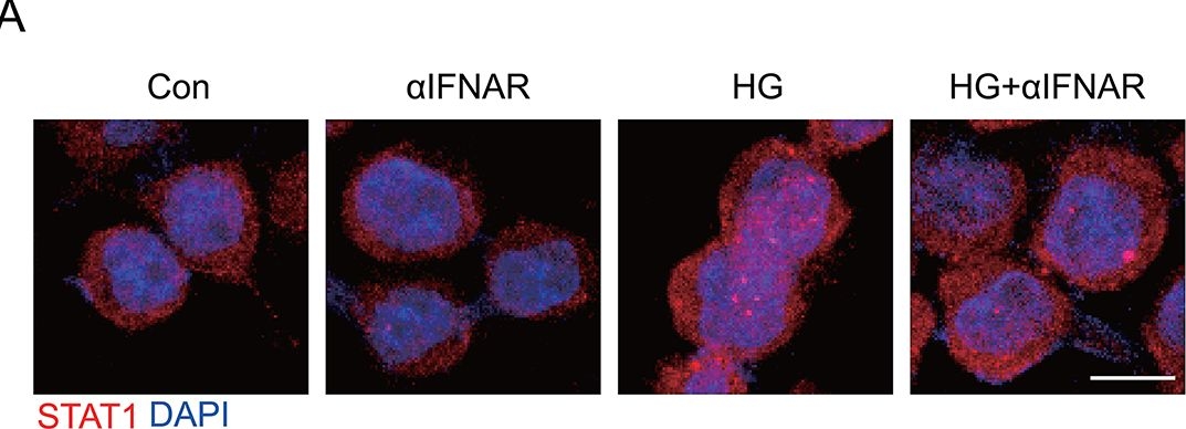 Fig.5.A showing Immunocytochemistry-immunofluorescence in a Mus musculus (House mouse) sample from the publication: Intermittent hypoxia exacerbates anxiety in high-fat diet-induced diabetic mice by inhibiting TREM2-regulated IFNAR1 signaling.