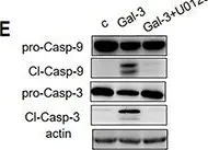 Fig.2.E showing Western Blotting from the publication: The N-terminal tail coordinates with carbohydrate recognition domain to mediate galectin-3 induced apoptosis in T cells.