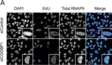 Fig.10.A showing Immunocytochemistry-immunofluorescence in a Homo sapiens (Human) sample from the publication: The CGG triplet repeat binding protein 1 counteracts R-loop induced transcription-replication stress.