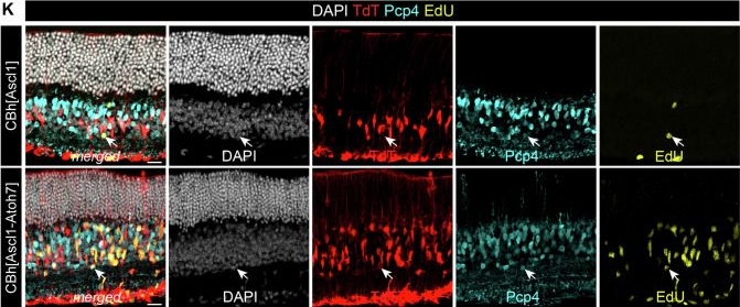 Fig.4.K showing Immunohistochemistry-immunofluorescence from the publication: AAV-mediated expression of proneural factors stimulates neurogenesis from adult Müller glia in vivo.