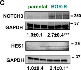 Fig.5.C showing Western Blotting from the publication: Targeting NOTCH3 to eradicate dormant and therapy-resistant multiple myeloma cells.