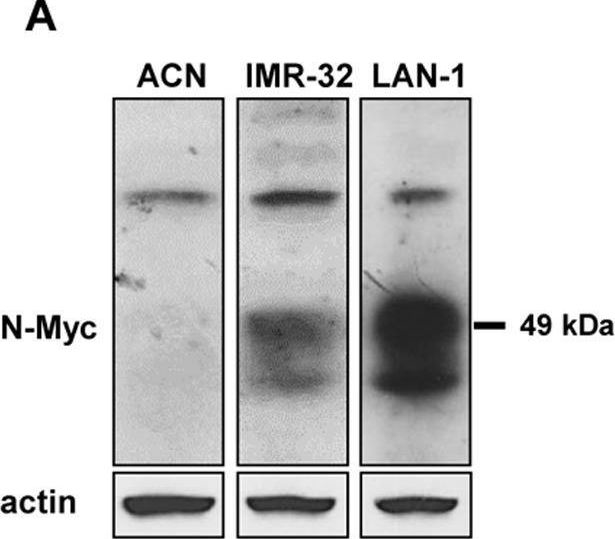 Fig.1.A showing Western Blotting in a Homo sapiens (Human) sample from the publication: Immunohistochemical analysis of PDK1, PHD3 and HIF-1α expression defines the hypoxic status of neuroblastoma tumors.