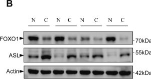 Fig.7.B showing Western Blotting from the publication: FOXO1-mediated argininosuccinate lyase transcription inhibits ammonia metabolism and breast cancer cell metastasis.