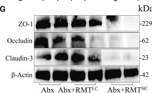 Fig.3.G showing Western Blotting from the publication: Ruminal microbial dysbiosis induces mastitis in dairy goats by activating oxidative stress and ferritinophagy-ferroptosis.