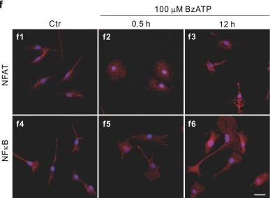 Fig.8.F showing Immunocytochemistry-immunofluorescence in a Mus musculus (House mouse) sample from the publication: Interplay between Müller cells and microglia aggravates retinal inflammatory response in experimental glaucoma.