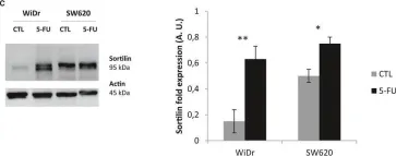 Fig.1.C showing Western Blotting from the publication: Overexpression of sortilin is associated with 5-FU resistance and poor prognosis in colorectal cancer.