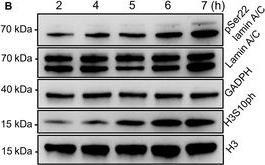 Fig.5.B showing Western Blotting in a Homo sapiens (Human) sample from the publication: Genetically Encoded Fluorescence Resonance Energy Transfer Biosensor for Live-Cell Visualization of Lamin A Phosphorylation at Serine 22.