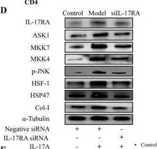 Fig.9.D showing Western Blotting from the publication: Lactobacillus paracasei L9 Ameliorates Pulmonary Fibrosis in Aged Mice via Gut-Lung Axis-Mediated Regulation of Immune Cell Migration.