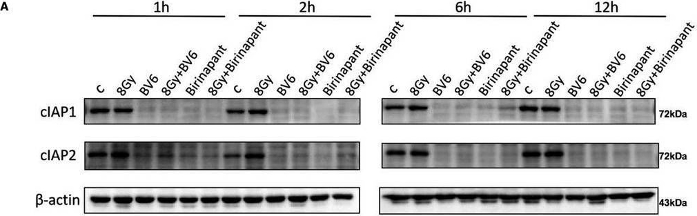 Fig.5.A showing Western Blotting in a Homo sapiens (Human) sample from the publication: cIAP1/2 are involved in the radiosensitizing effect of birinapant on NSCLC cell line in vitro.