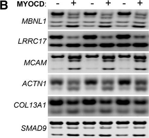 Fig.5.B showing Western Blotting in a Homo sapiens (Human) sample from the publication: Myocardin regulates exon usage in smooth muscle cells through induction of splicing regulatory factors.