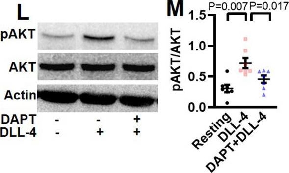Fig.3.L showing Western Blotting from the publication: Notch signaling functions in noncanonical juxtacrine manner in platelets to amplify thrombogenicity.