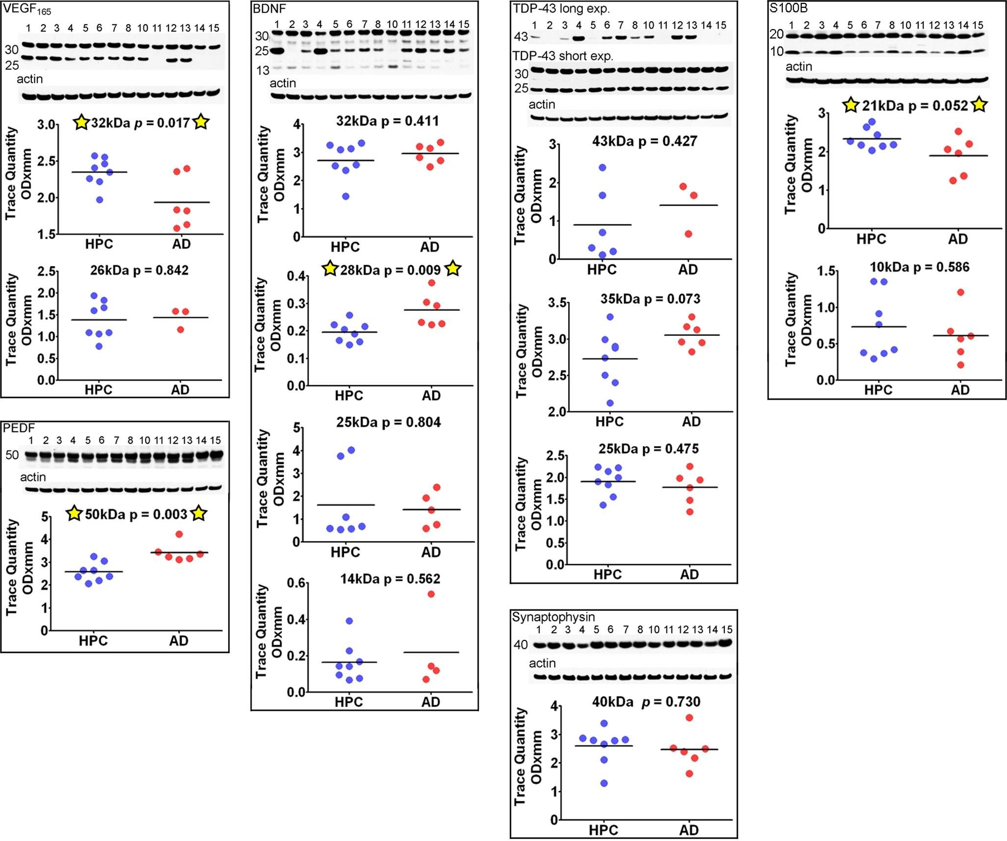 Fig.7.A showing Western Blotting in a Homo sapiens (Human) sample from the publication: Alzheimer's disease and non-demented high pathology control nonagenarians: comparing and contrasting the biochemistry of cognitively successful aging.