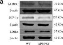 acorn様分 Anti HIF-1 Alpha Antibody (D1S7W) Rabbit mAb | Cell Signaling