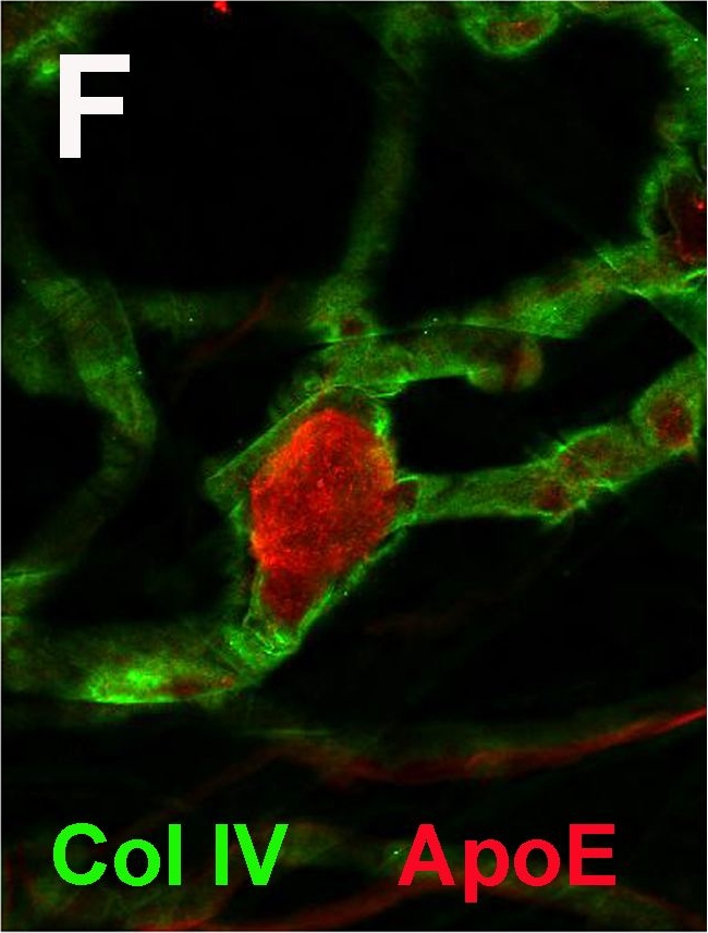 Fig.4.F showing Immunocytochemistry-immunofluorescence in a Homo sapiens (Human) sample from the publication: Diabetes-related changes in the protein composition and the biomechanical properties of human retinal vascular basement membranes.