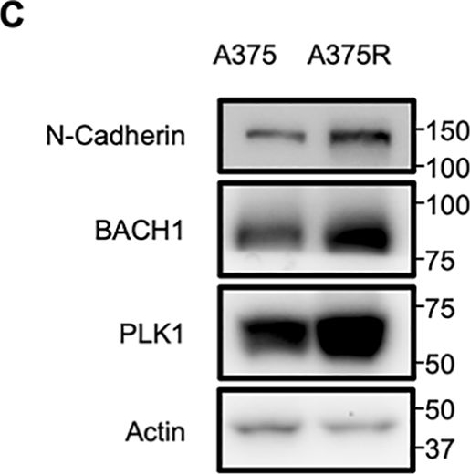 Fig.3.C showing Western Blotting from the publication: The cell cycle regulator PLK1 promotes murine melanoma progression by regulating the transcription factor BACH1.