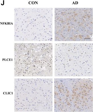 Fig.11.J showing Immunohistochemistry in a Mus musculus (House mouse) sample from the publication: Novel diagnostic biomarkers of oxidative stress, immunological characterization and experimental validation in Alzheimer's disease.