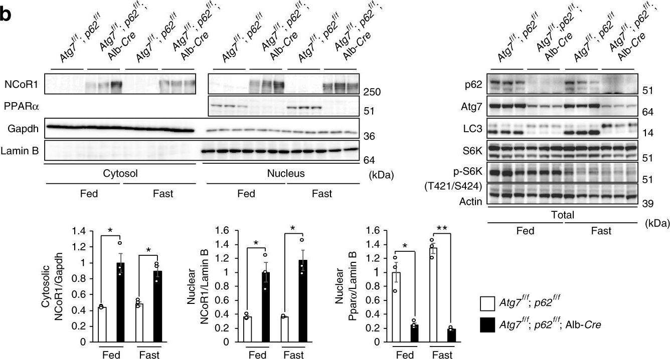 Autophagy regulates lipid metabolism through selective turnover of NCoR1.
