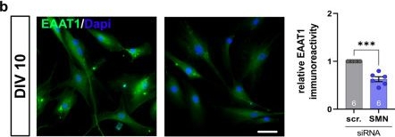 Fig.9.B showing Immunocytochemistry-immunofluorescence in a Mus musculus (House mouse) sample from the publication: Spinal astrocyte dysfunction drives motor neuron loss in late-onset spinal muscular atrophy.